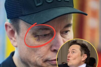 BREAKING NEWS: Did somebody beat him up …, speculations go viral as Elon Musk turns up with Black eye at White House; he says got it while …