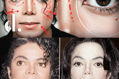 Not Plastic Surgery: 5 Other Ways Michael Jackson Drastically Altered His Appearance