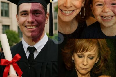 A newborn baby was abandoned by a wealthy family simply because of a dark birthmark on his face. The mark became a symbol of judgment — a reason to reject, to look away, to walk past. Alone and vulnerable, the child was left with nothing but silence and stigma. But everything changed when Reba McEntire, the beloved Queen of Country, quietly learned about the baby’s story. What she did next — without cameras, without press — was something no one saw coming. A single act. A powerful message. And a decision that’s now touching hearts around the world. Full story👇👇
