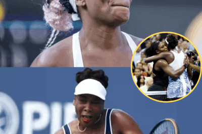 Serena Williams’ sister Venus Williams has one unavoidable condition for considering for getting plastic surgery