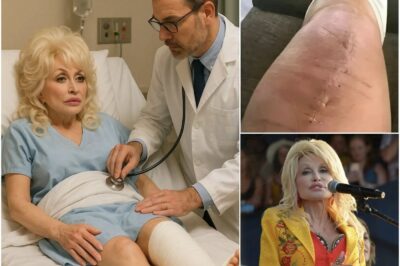 Dolly Parton Recovering After Leg Surgery Following Sudden Fall