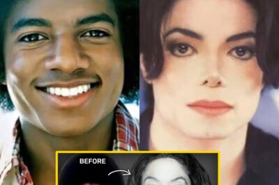 How Much Plastic Surgery Did Michael Jackson Actually Have?!! NEW DETAILS.q