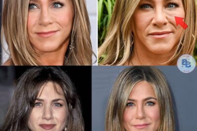 Jennifer Aniston addresses plastic surgery rumours as star reveals the work she’s had done