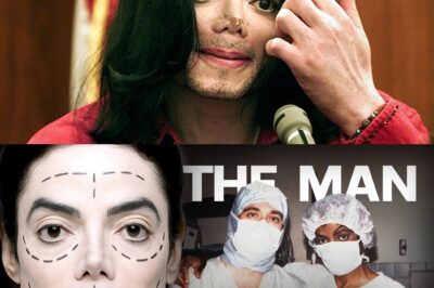 The Dark World Of Michael Jackson’s INFAMOUS Plastic Surgeon