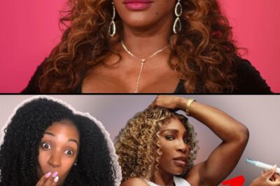 Is Serena Williams Falling Victim to European Beauty Standards!?