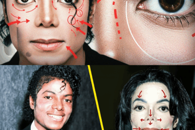 The Real Reason Michael Jackson Was Obsessed With Plastic Surgery Will Blow Your Mind