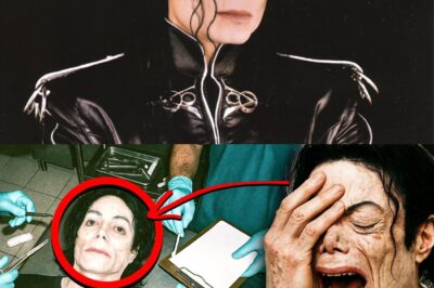 Michael Jackson’s Autopsy Exposes The Terrifying Truth He Tried To Hide Behind His Plastic Surgeries